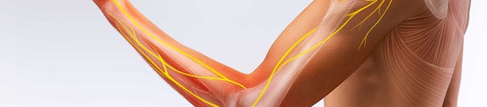 Polyneuritis2.jpg